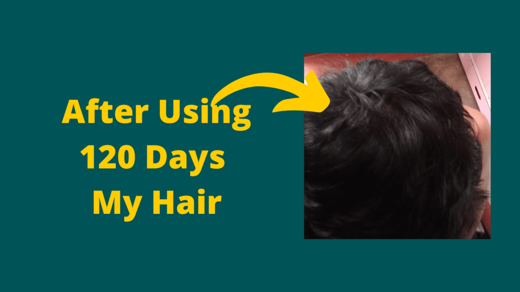 after using 120 days my hair fall stop